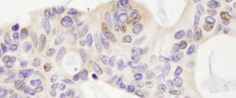 USP28 Antibody (aa500-550)