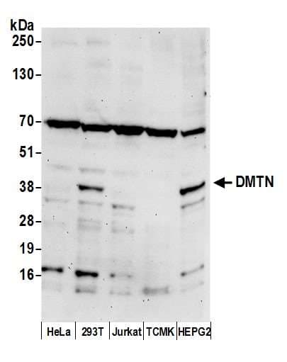 Polyclonal Rabbit anti-Human DMTN / Dematin Antibody (aa225-275, WB)