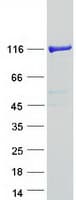 Human PHKB Protein (Recombinant Myc-DDK (Flag))