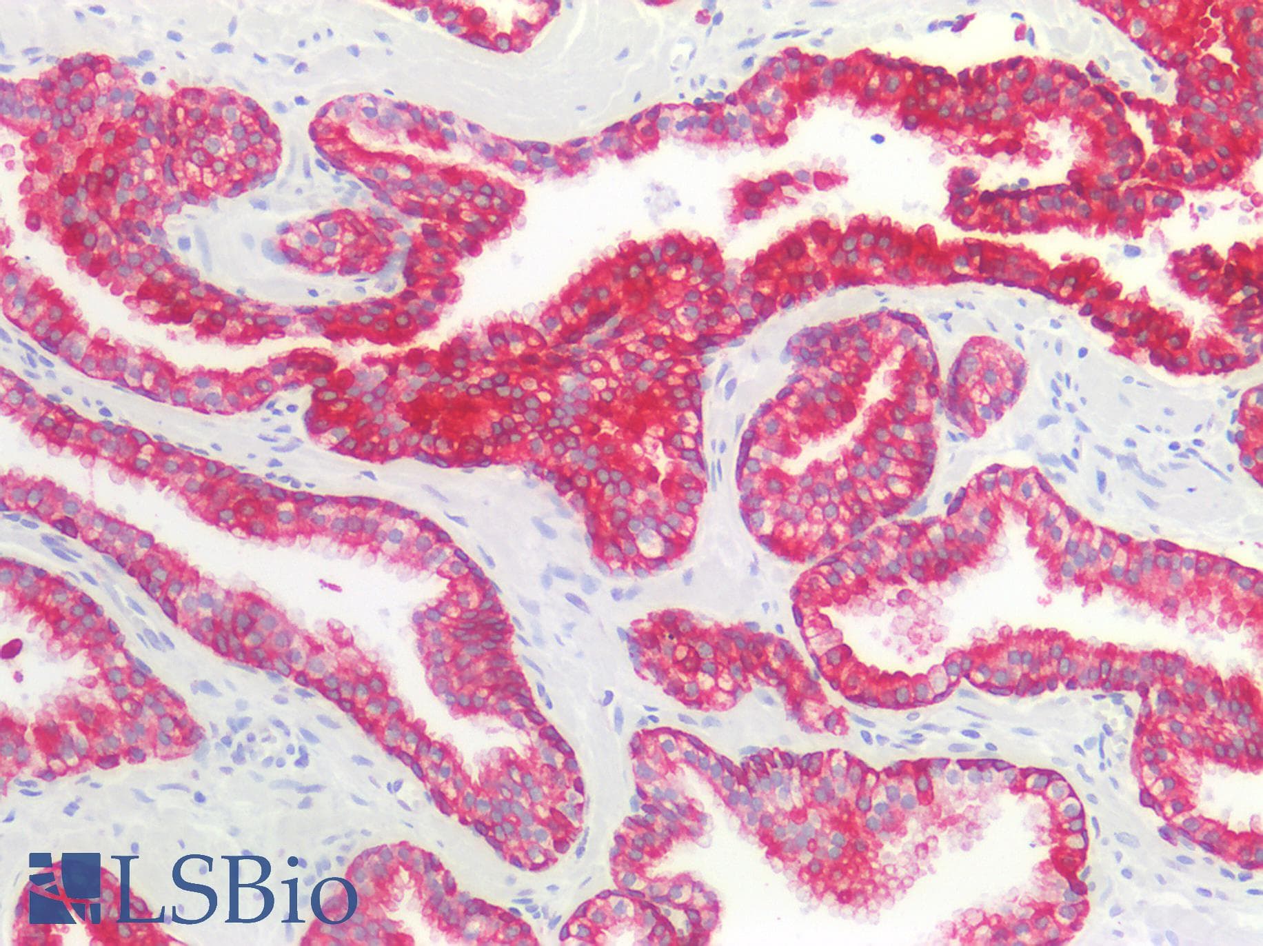 PathPlus™ Monoclonal Mouse anti-Human Cytokeratin AE1+AE3 Antibody (clone AE1+AE3, IHC)