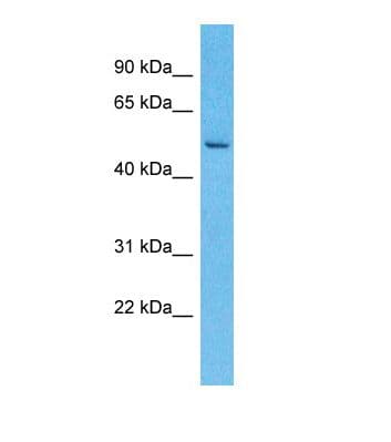LRRC14 Antibody (aa62-111)