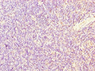Polyclonal Rabbit anti-Human SFXN4 Antibody (IHC, WB)