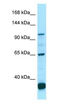Polyclonal Rabbit anti-Human PDE6C Antibody (C-Terminus, WB)