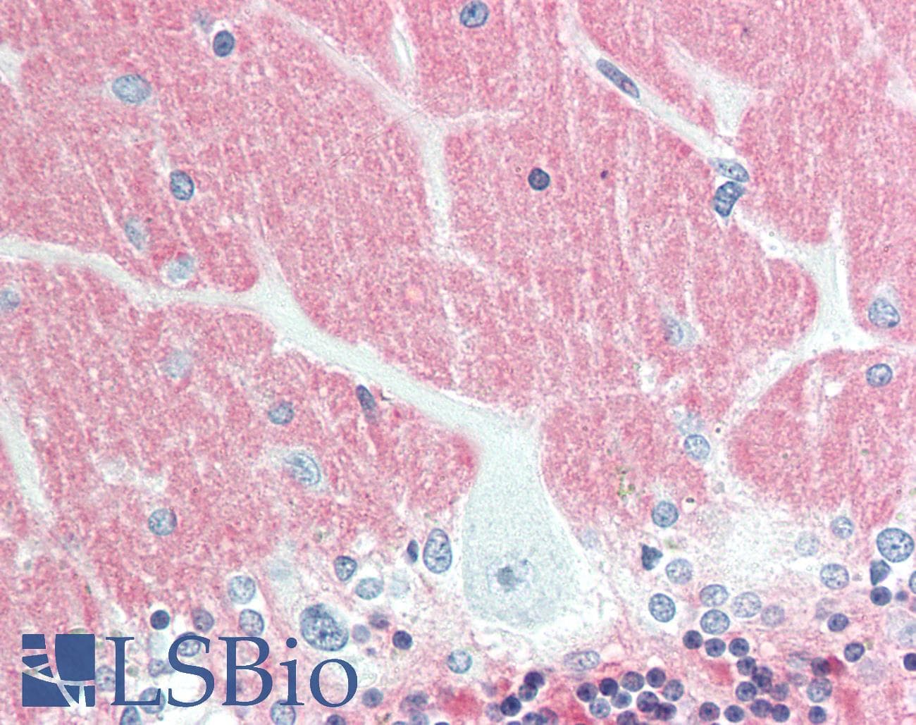 IHC-plus™ VILIP / VSNL1 Antibody (clone 3A9)