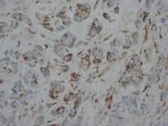 HSPB1 / HSP27 Antibody (C-Terminus)