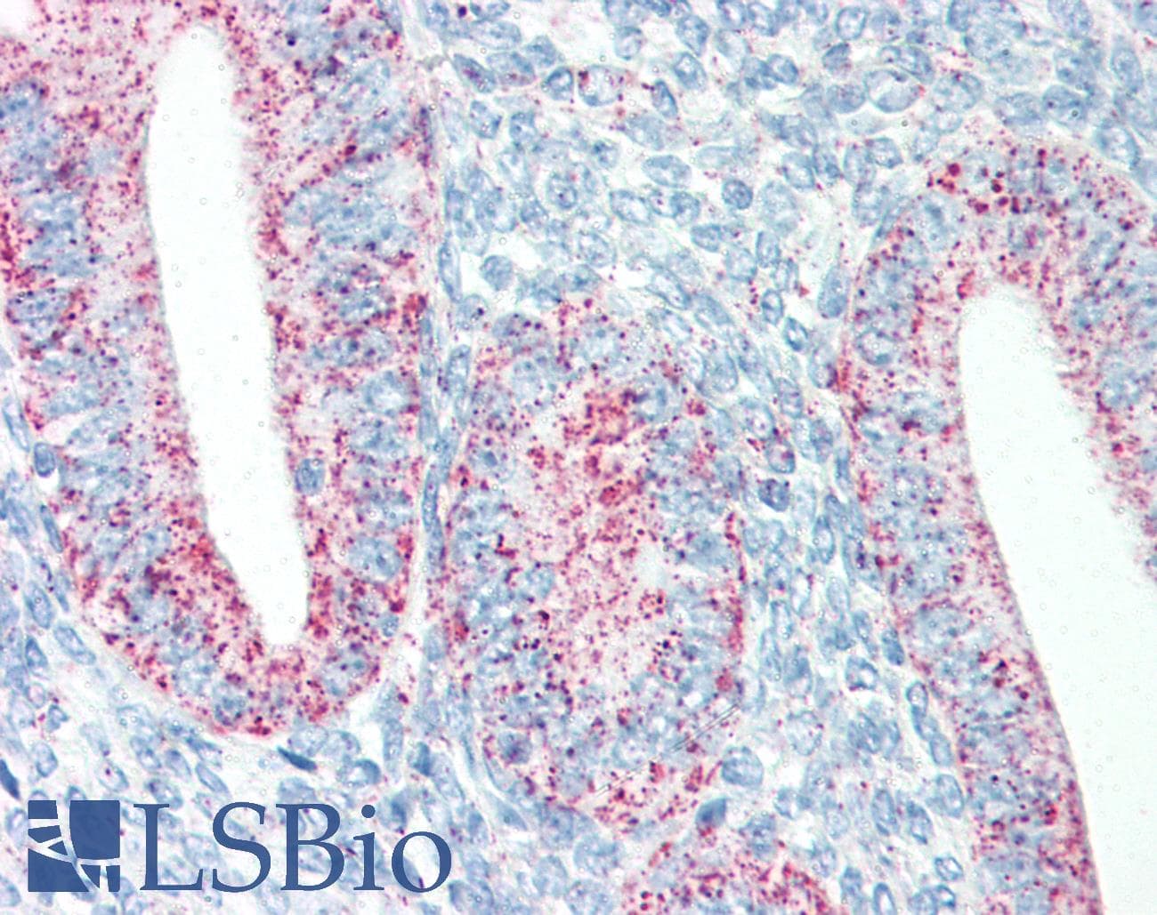 IHC-plus™ HSPD1 / HSP60 Antibody