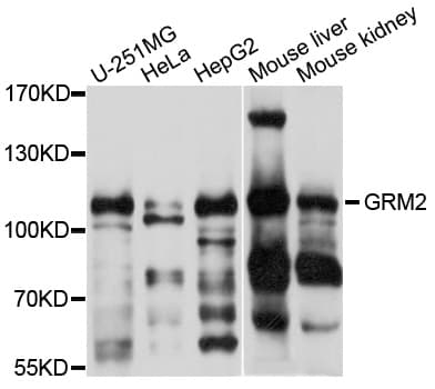 GRM2 / MGLUR2 Antibody