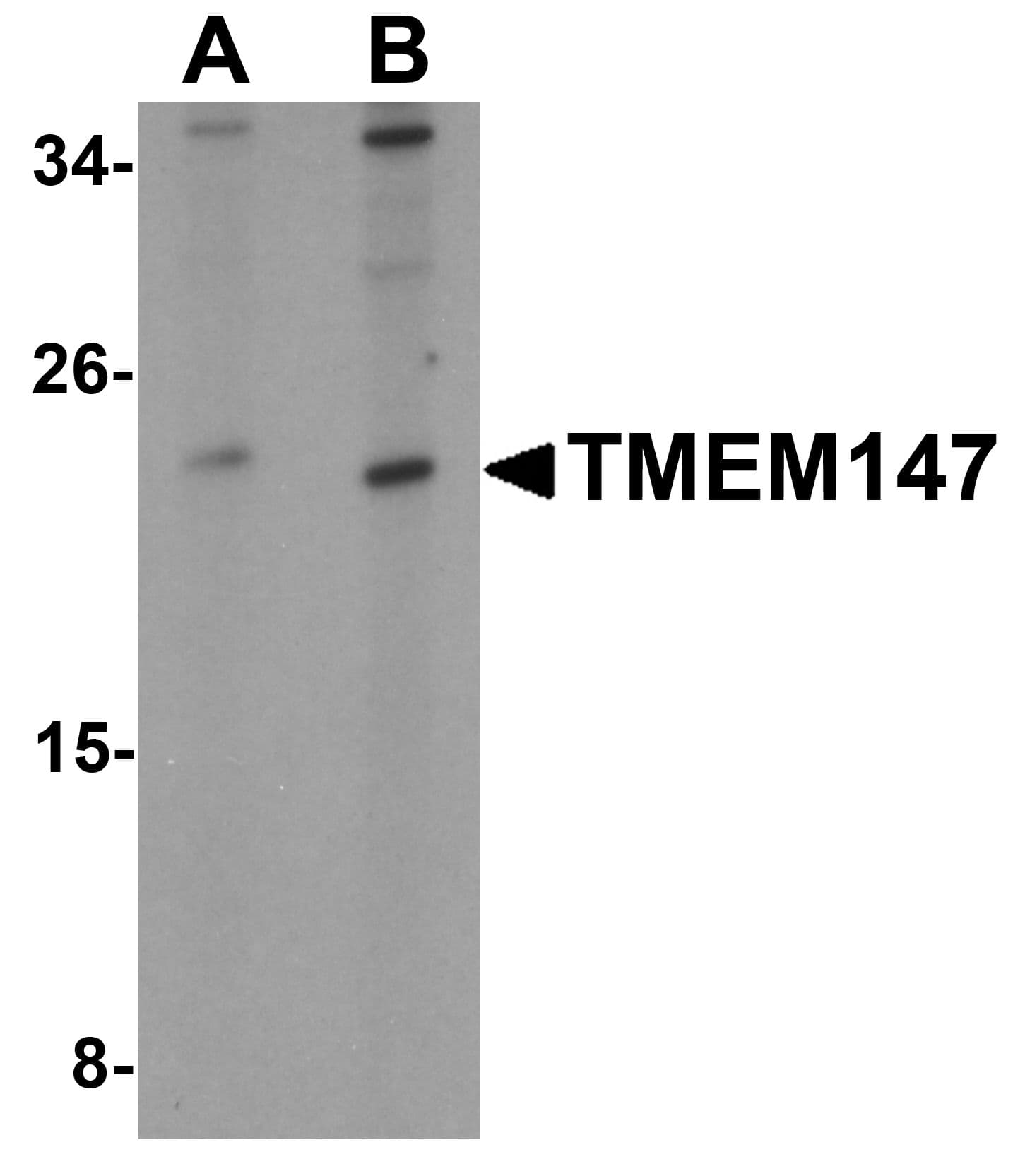 IHC-plus™ TMEM147 Antibody
