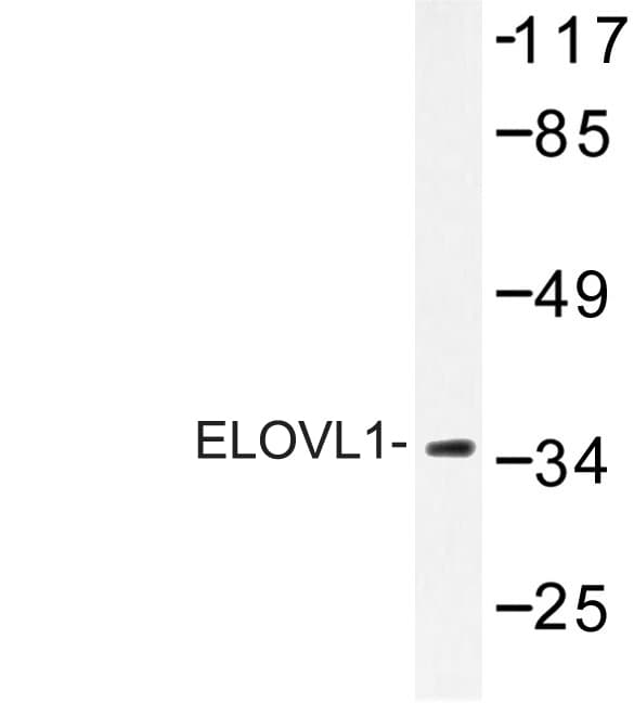 Polyclonal Rabbit anti-Human ELOVL1 Antibody (Phe139, WB)