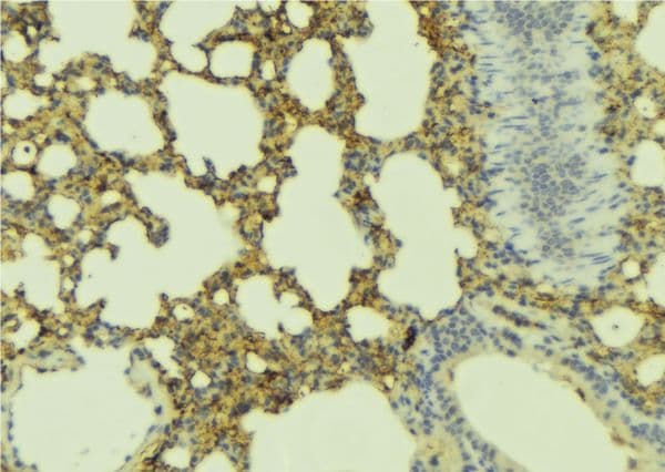 Polyclonal Rabbit anti-Human ADCYAP1R1 / PAC1 Receptor Antibody (IHC, WB)