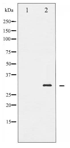 BCL2 / Bcl-2 Antibody (phospho-Ser70)