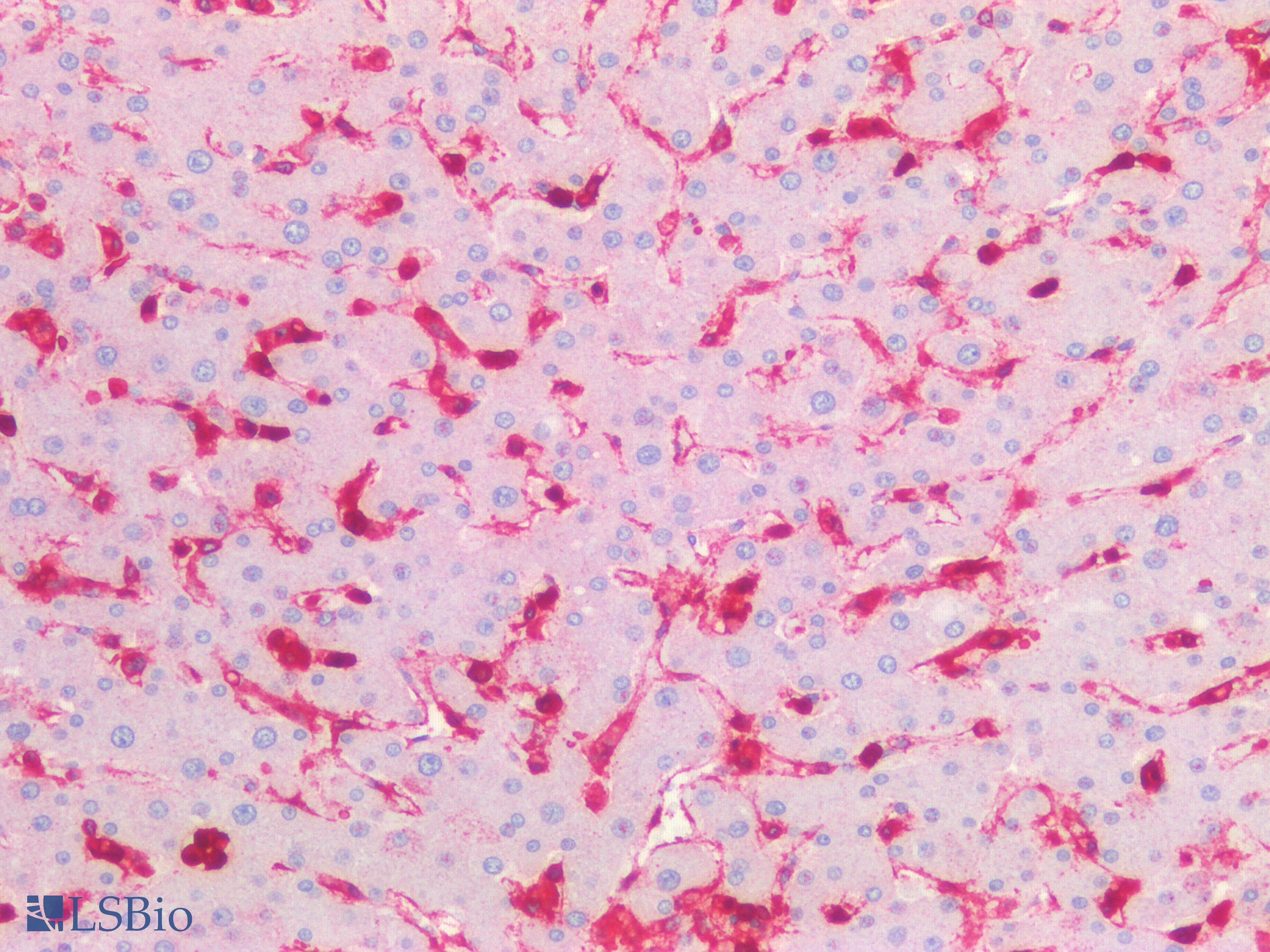 IHC-plus™ Polyclonal Rabbit anti-Human ANXA1 / Annexin A1 Antibody (Internal, IHC, IF, WB)