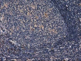 CAT / Catalase Antibody (clone 1B6, Carrier-free)