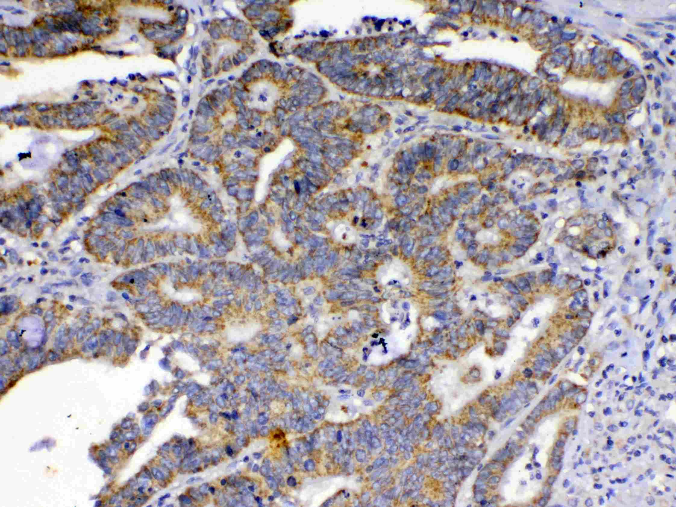 Polyclonal Rabbit anti-Human KITLG / SCF Antibody (IHC, WB)