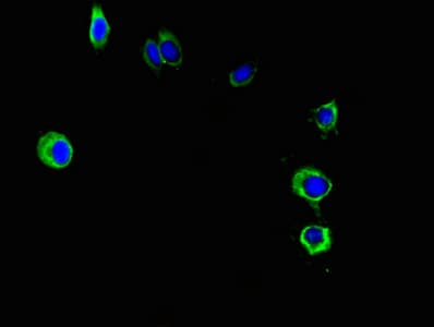 PNPLA2 / ATGL Antibody