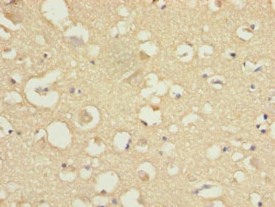 Polyclonal Rabbit anti-Human COPZ1 Antibody (IHC, WB)