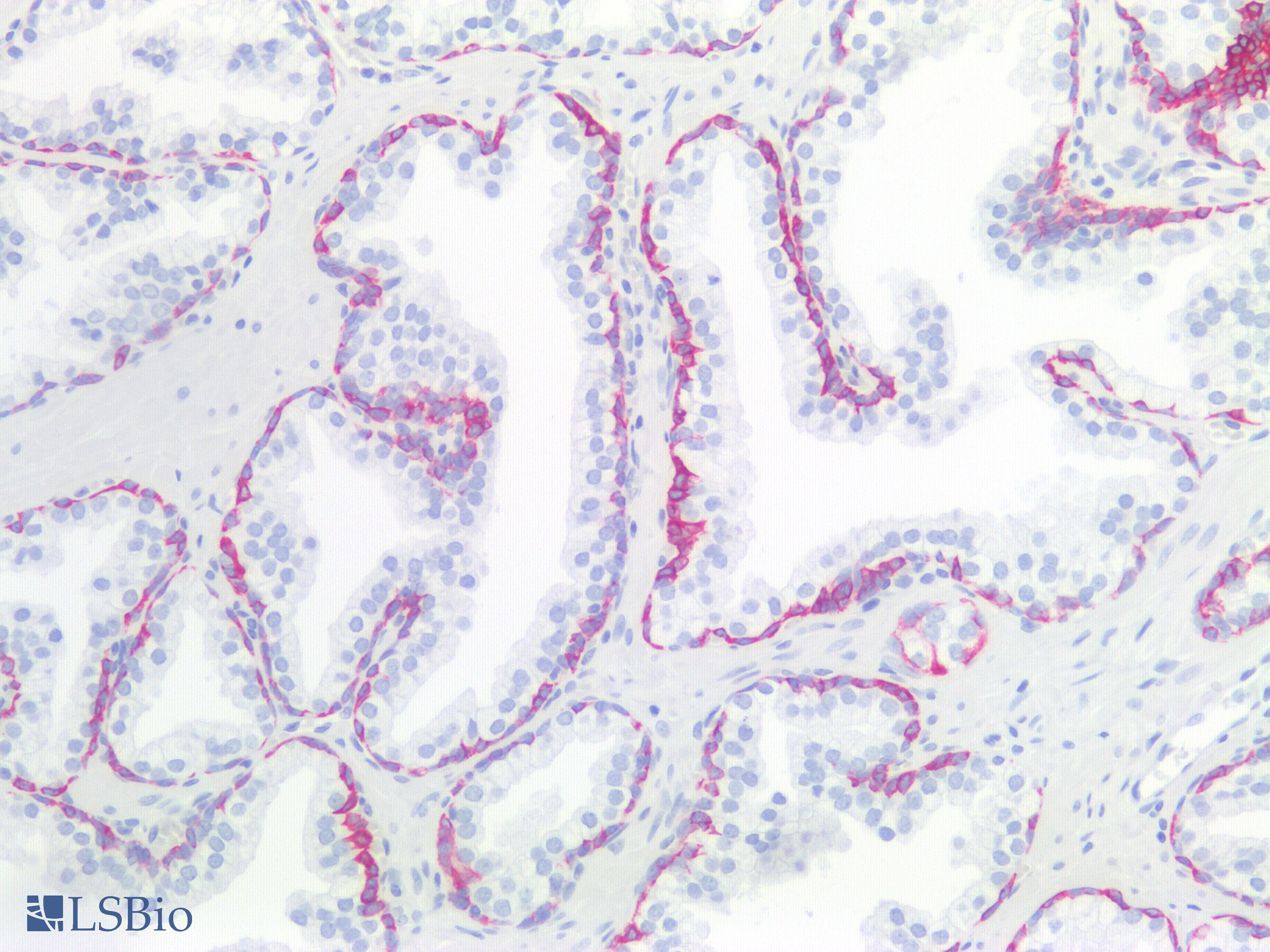 PathPlus™ Keratin, HMW Antibody (clone 34BE12)