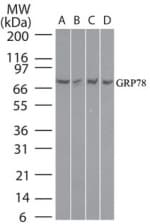 IHC-plus™ HSPA5 / GRP78 / BiP Antibody (aa550-600)