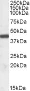 IHC-plus™ Polyclonal Goat anti-Human NF45 / ILF2 Antibody (aa355-367, IHC, WB)