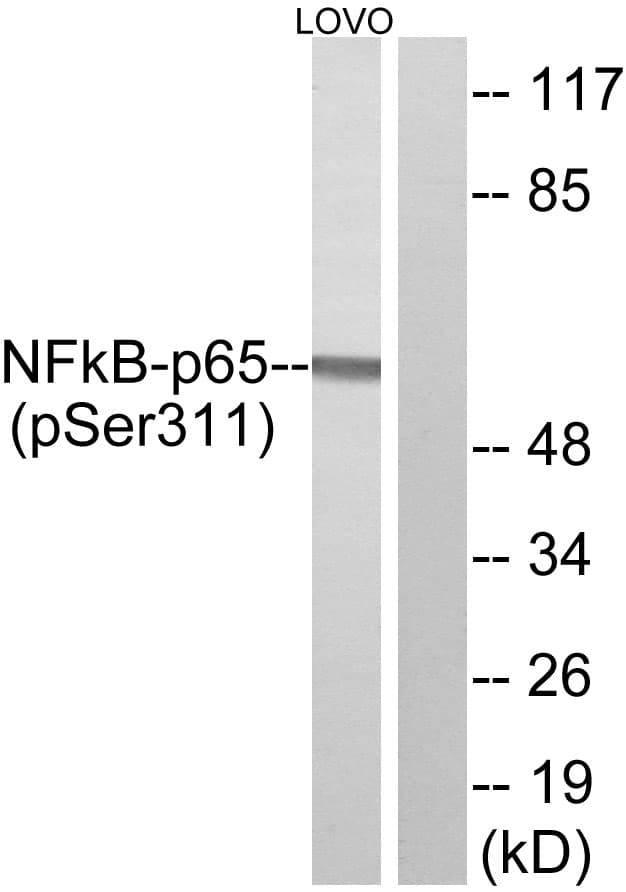 RELA / NFKB p65 Antibody (phospho-Ser311)