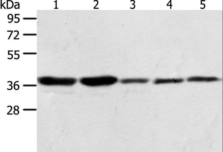 ANXA1 / Annexin A1 Antibody