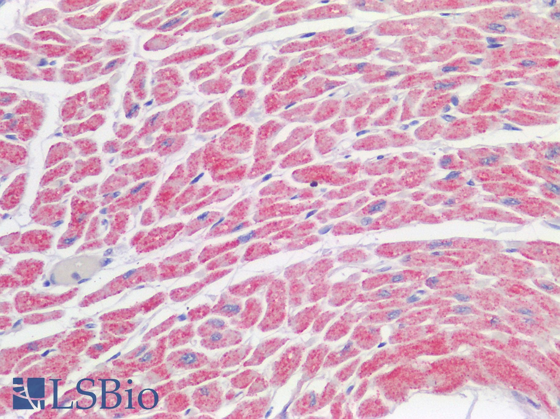 IHC-plus™ Polyclonal Rabbit anti-Human VDAC2 Antibody (N-Terminus, IHC)
