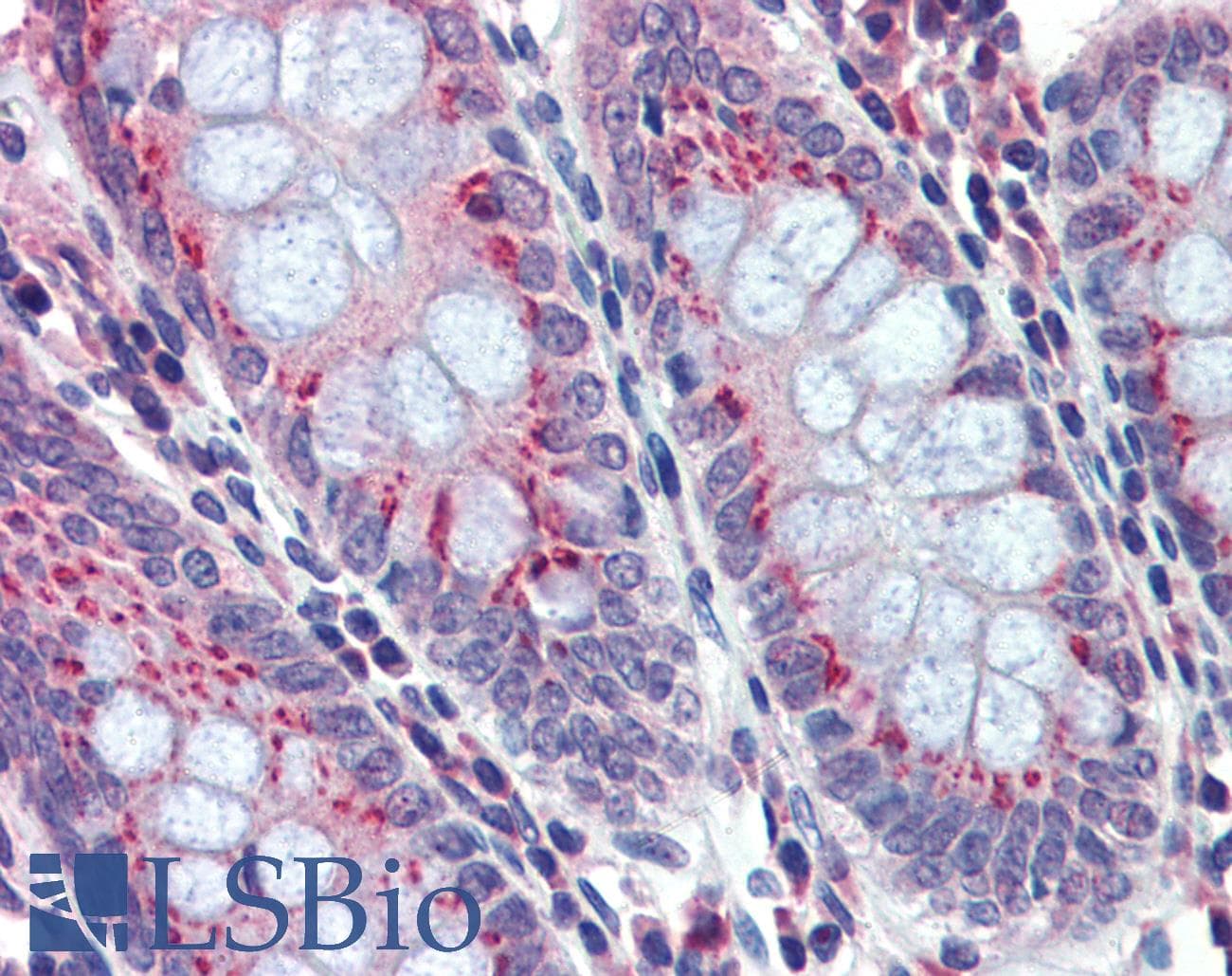 PathPlus™ Polyclonal Rabbit anti-Human BACE2 Antibody (IHC, WB)