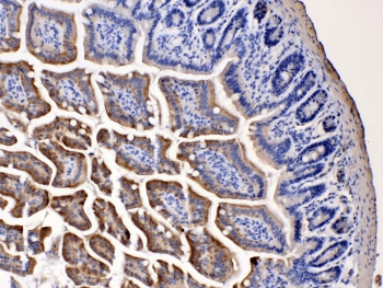 NARG1 / NAA15 Antibody