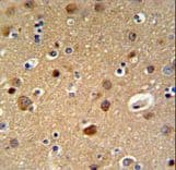 Polyclonal Rabbit anti-Human TELO2 Antibody (aa786-812, IHC, WB)
