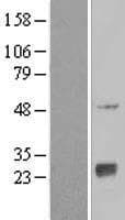 EBS / NAT9 Protein (Over-Expression Lysate Myc-DDK (Flag))