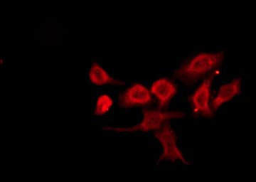 Polyclonal Rabbit anti-Human OR13D1 Antibody (IF, WB)