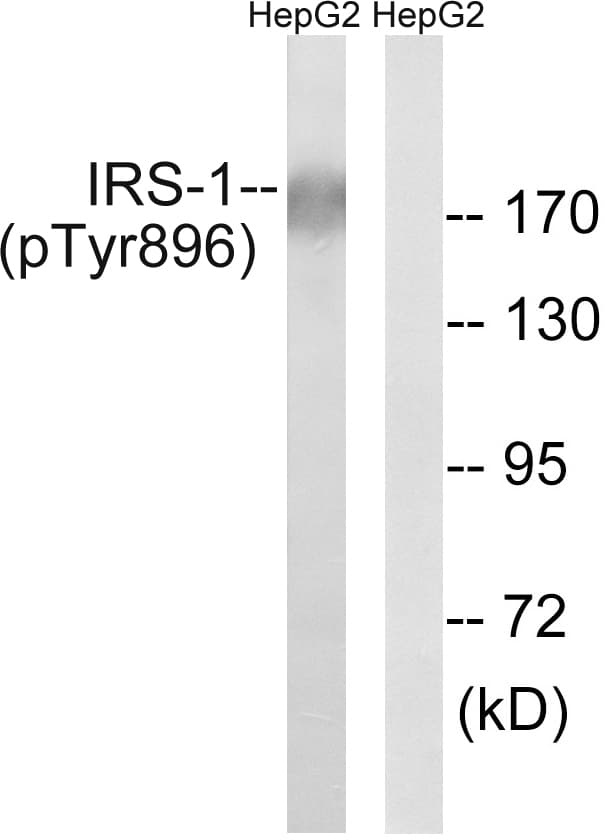 IRS1 Antibody (phospho-Tyr896)