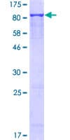 Human ERO1A / ERO1L Protein (Recombinant GST)
