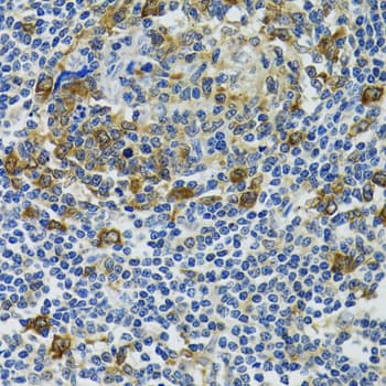 Polyclonal Rabbit anti-Human HSPH1 / HSP105 Antibody (IHC, WB)