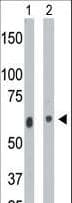 IHC-plus™ Ceramide Kinase / CERK Antibody (aa487-516)