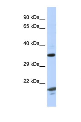 Polyclonal Rabbit anti-Human CHN1 Antibody (aa229-278, WB)