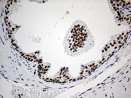ELL / MEN Antibody (aa302-621, clone OTI1G2)