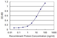 COL14A1 / Collagen XIV Antibody (clone 1C8)