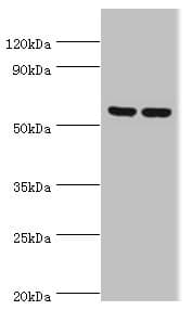 PRKAG3 / AMPK Gamma 3 Antibody (aa1-210)