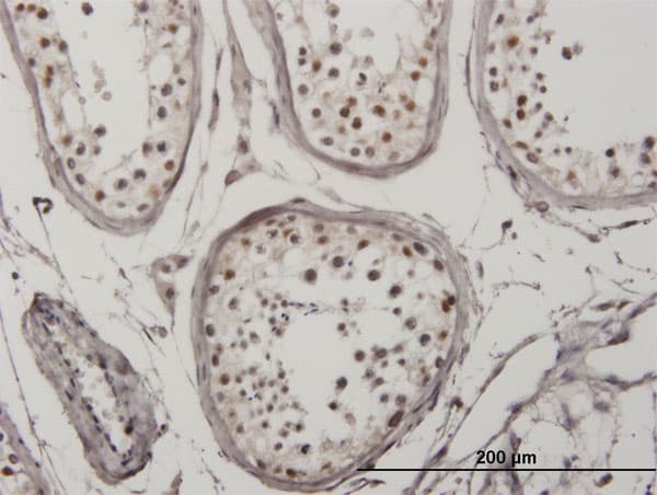 Monoclonal Mouse anti-Human IRF5 Antibody (clone 2D4, IHC, IF, WB)