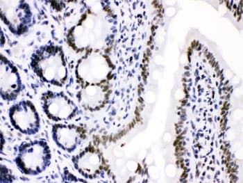CDK9 Antibody