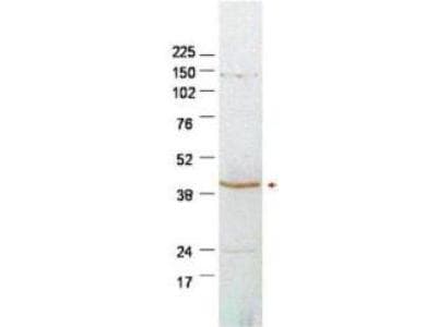 IHC-plus™ SERPINB2 / PAI-2 Antibody (Internal)