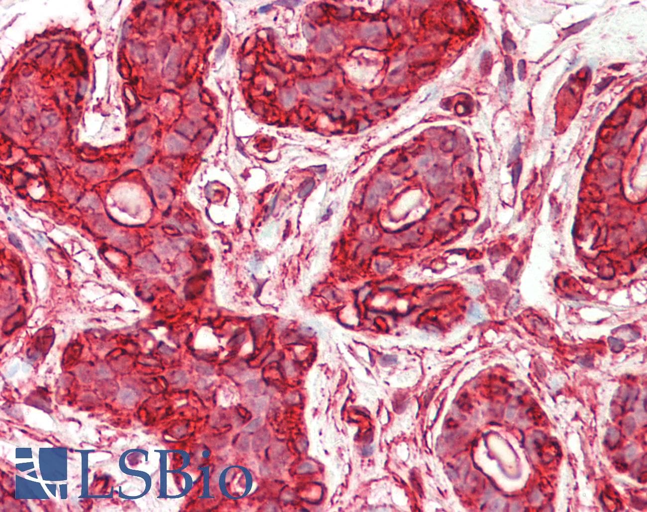 IHC-plus™ Monoclonal Mouse anti-Human ACTG1 / Gamma Actin Antibody (clone 2A3, N-Terminus, IHC, IF, WB)