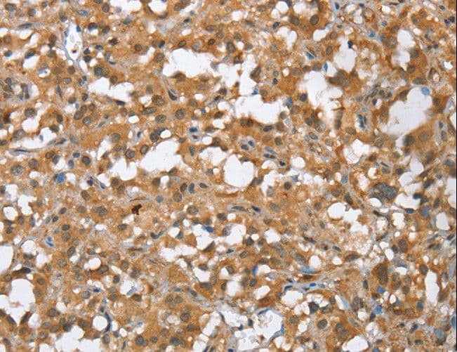 Polyclonal Rabbit anti-Human MMP12 Antibody (IHC)