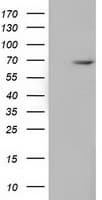 Monoclonal Mouse anti-Human EPM2AIP1 Antibody (clone OTI5G8, IF, WB)