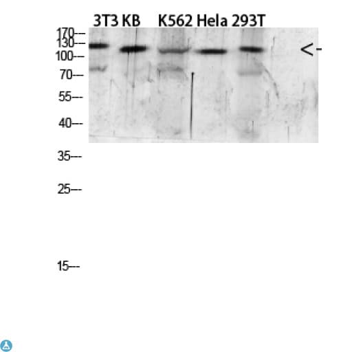 Polyclonal Rabbit anti-Human EGF Antibody (IHC, WB)