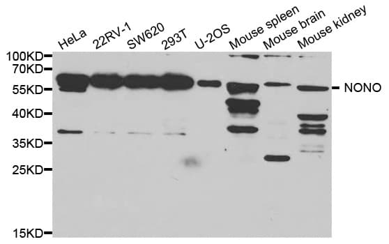 Polyclonal Rabbit anti-Human NONO / P54NRB Antibody (IHC, IF, WB)