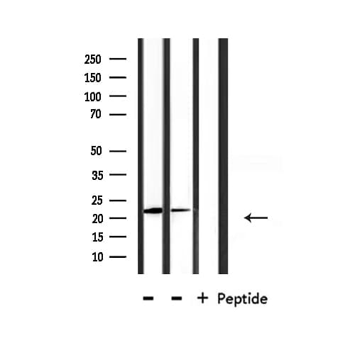 Polyclonal Rabbit anti-Human GBTS1 / DIRAS1 Antibody (IF, WB)