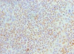 Polyclonal Rabbit anti-Human MCM6 Antibody (aa562-821, IHC)