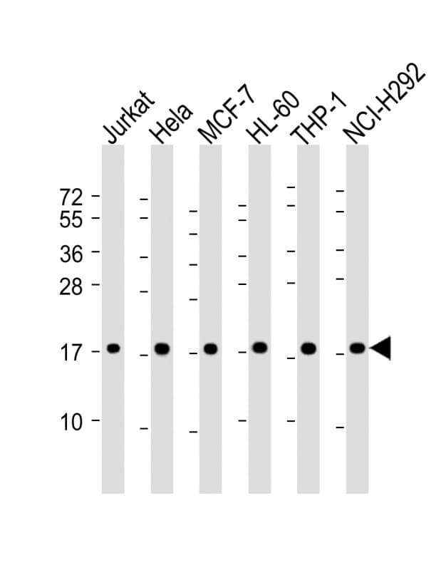 RPS17 / Ribosomal Protein S17 Antibody (Internal)